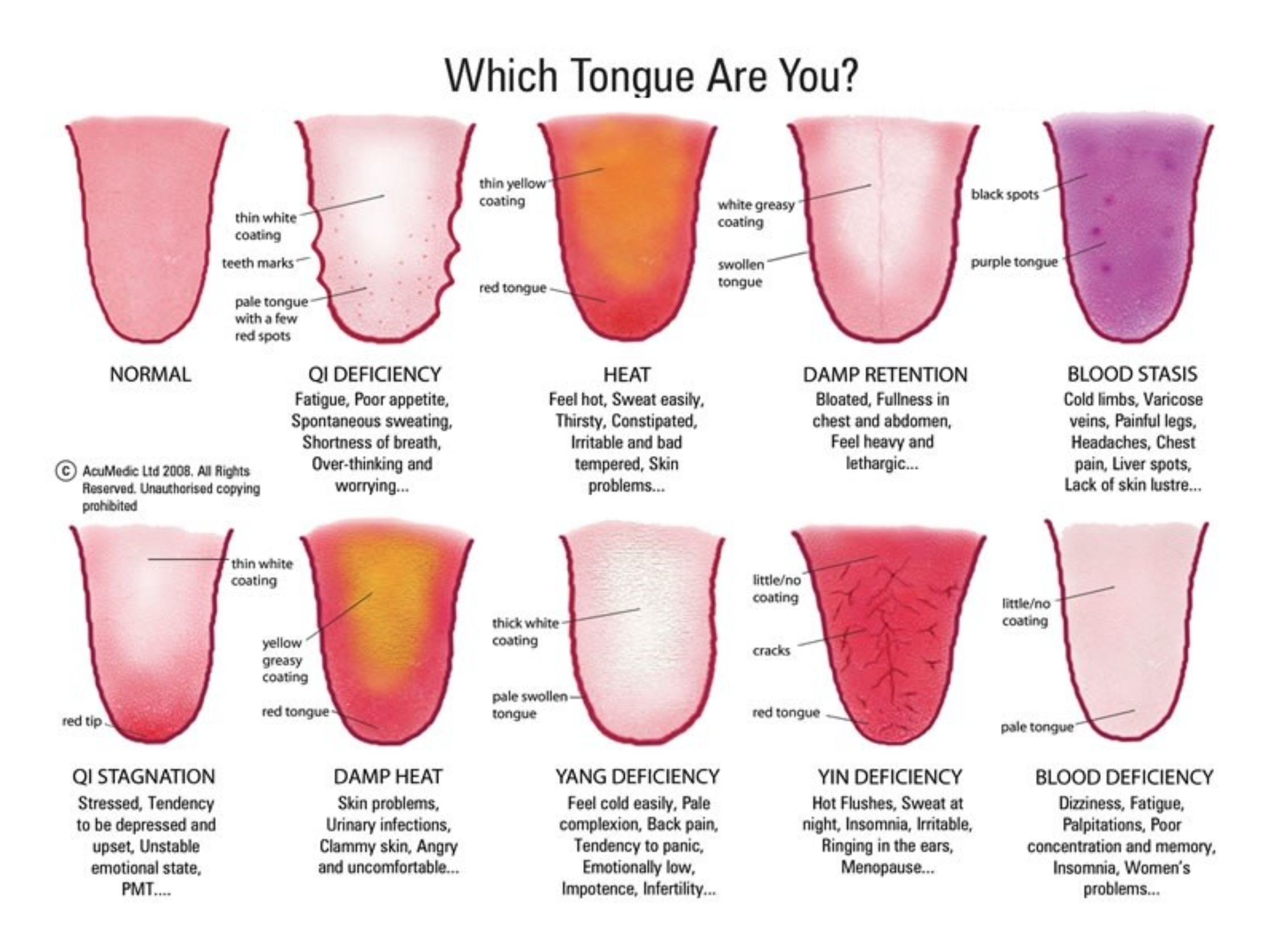 Tongue Diagnosis Colorado