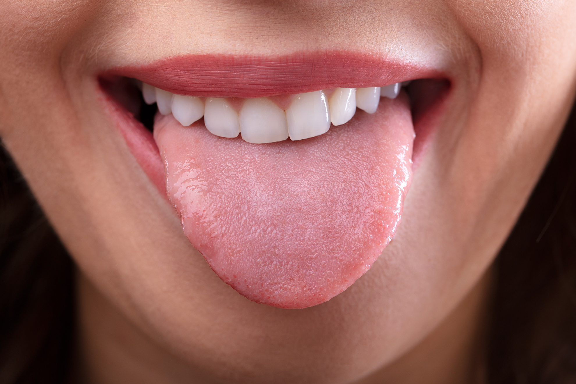 Tongue Diagnosis Jean Christophe Prin Acupuncture Fort Collins